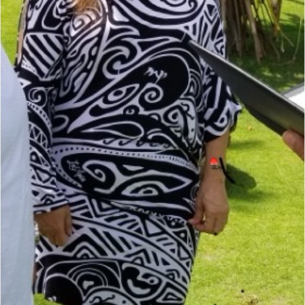 Missing Polynesia-Black And White Patterned Dress - image 5